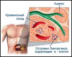 быстро похудеть к нвому году с помощью обертывания