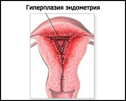 Боли в спине при беременности в 34 недель беременности